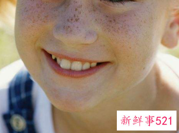 如何慢慢淡化雀斑