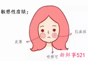 敏感性皮肤有什么特征