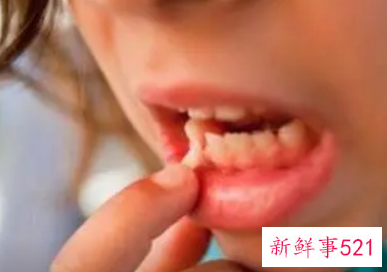 孕妇梦见牙是什么意思