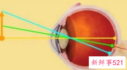 怎样才能控制儿童的眼睛度数增加