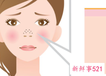 怎么改善脸部毛孔粗大