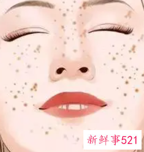 脸上长黑斑有的治吗