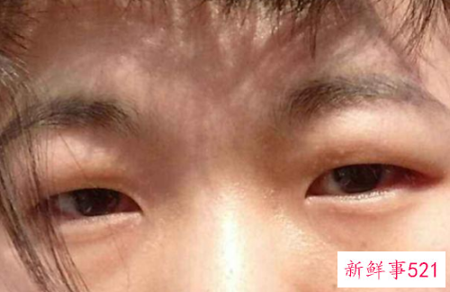 教你几个拯救肉泡眼的小窍门