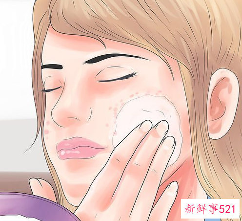 脸上有黑斑怎么办