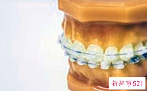 带牙套之后需要注意些什么