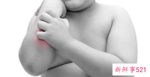 宝宝快速去痱子的方法