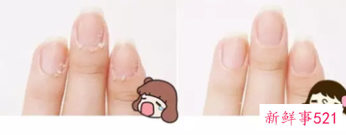 贴片美甲怎么自己卸掉