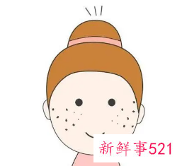 激光笔祛斑效果怎么样