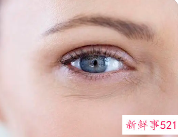 脸上有干纹和细纹怎么办