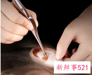 耳朵里抠着抠着湿漉漉的