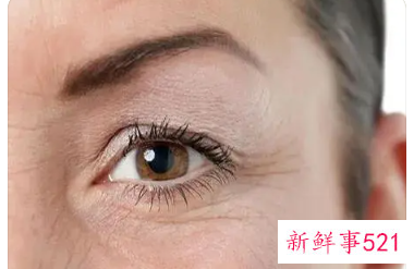 脸上有干纹和细纹怎么办