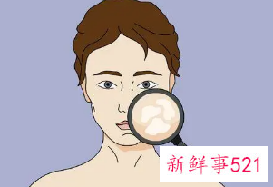 有什么办法可以变白