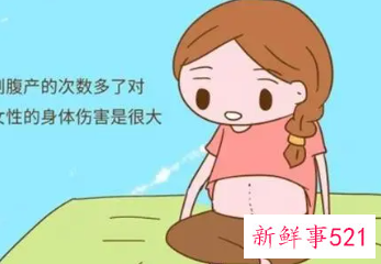 剖腹产后多久可以备孕二胎