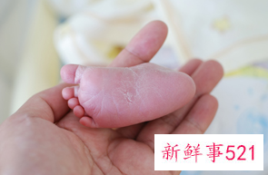 产前dna鉴定准吗