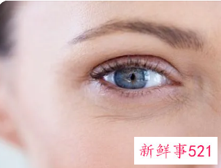 脸上起干纹怎么办