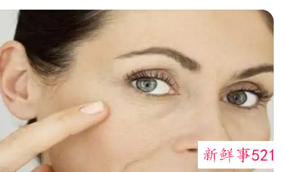 脸上有干纹和细纹怎么办