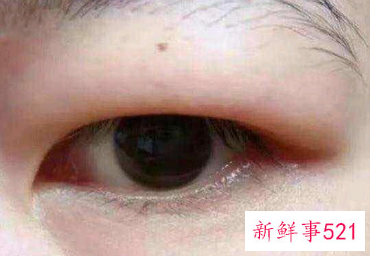 教你几个拯救肉泡眼的小窍门