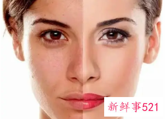 女性皮肤发黄暗沉怎么办