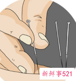 针灸的功效与作用