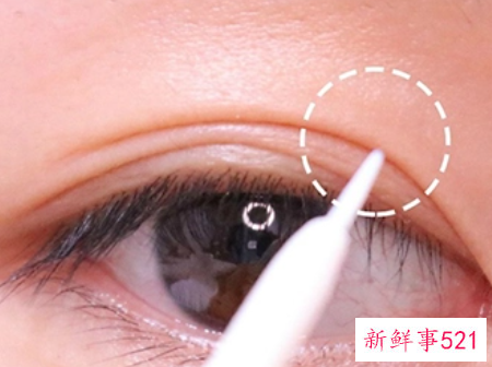 教你如何使用双眼皮胶水美容