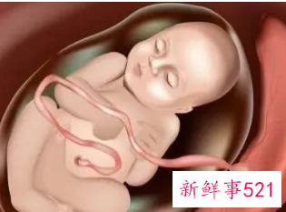 孕38周应该注意的问题