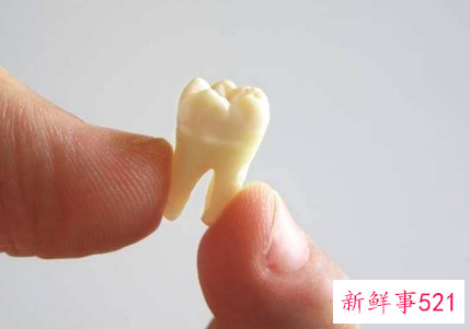 梦见自己牙齿掉了