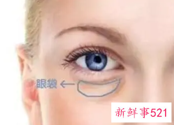 怎么样去眼袋又快又好