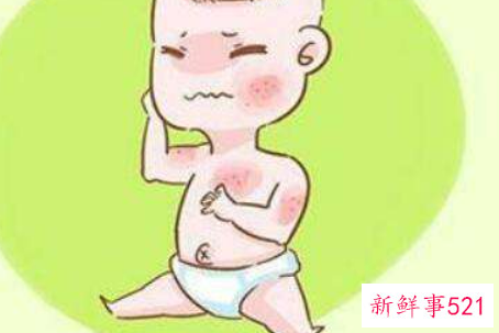 婴儿湿疹吃什么好