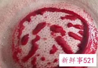 女生背部放血有啥好处