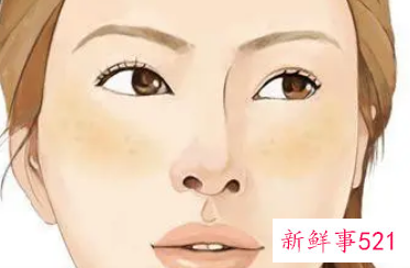 为什么脸上会长色素斑呢