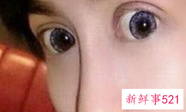 各种脸型适合的双眼皮