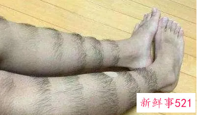 12岁女生去腿毛小妙招