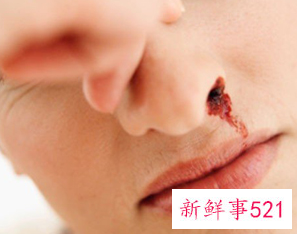 孕妇流鼻血的原因是什么
