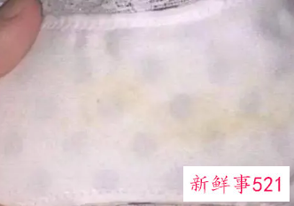 内裤发黄是什么妇科病