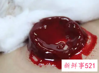 女生背部放血有啥好处