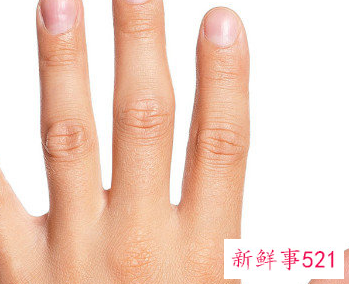 手上真菌感染早期症状