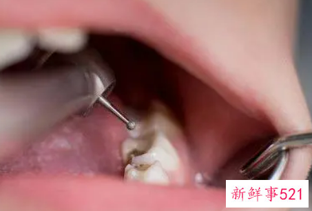 避免宝宝有蛀牙注意七件事