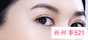 双眼皮眼头宽眼尾窄