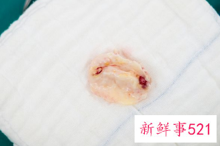 内裤发黄是什么妇科病