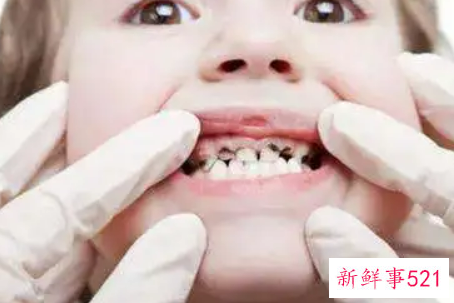 避免宝宝有蛀牙注意七件事