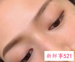 眉毛上的表情肌怎么样才能去掉
