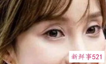 各种脸型适合的双眼皮