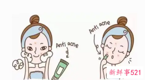 祛痘的神奇小窍门