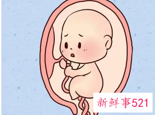 孕38周应该注意的问题