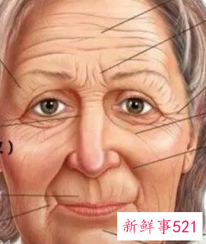 嘴周围的皱纹有什么办法消除