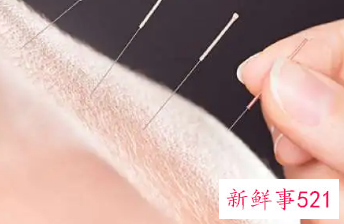 针灸的功效与作用