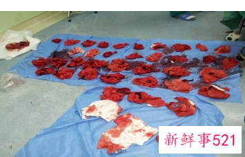 生孩子出血是什么意思