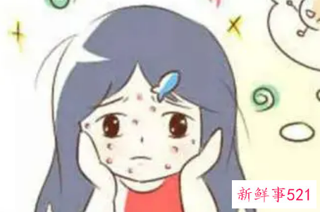 全方位祛痘攻略