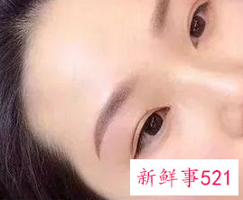 眉毛上的表情肌怎么样才能去掉