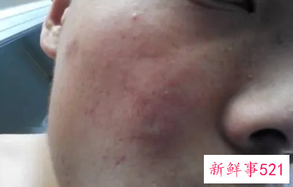 挤出来的油脂有臭味